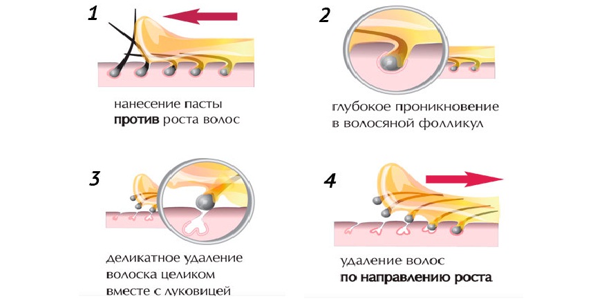 Как определить направление роста волос на ногах